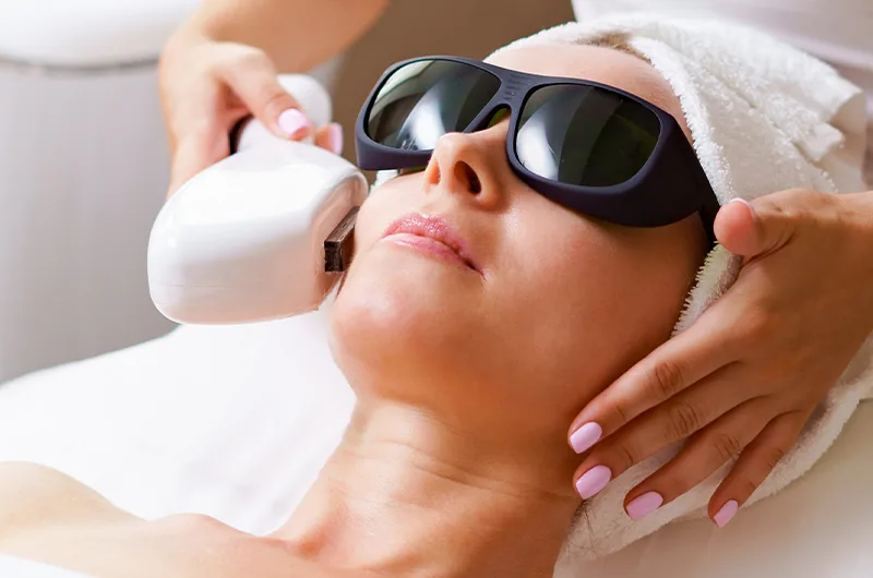 Laser hair removal