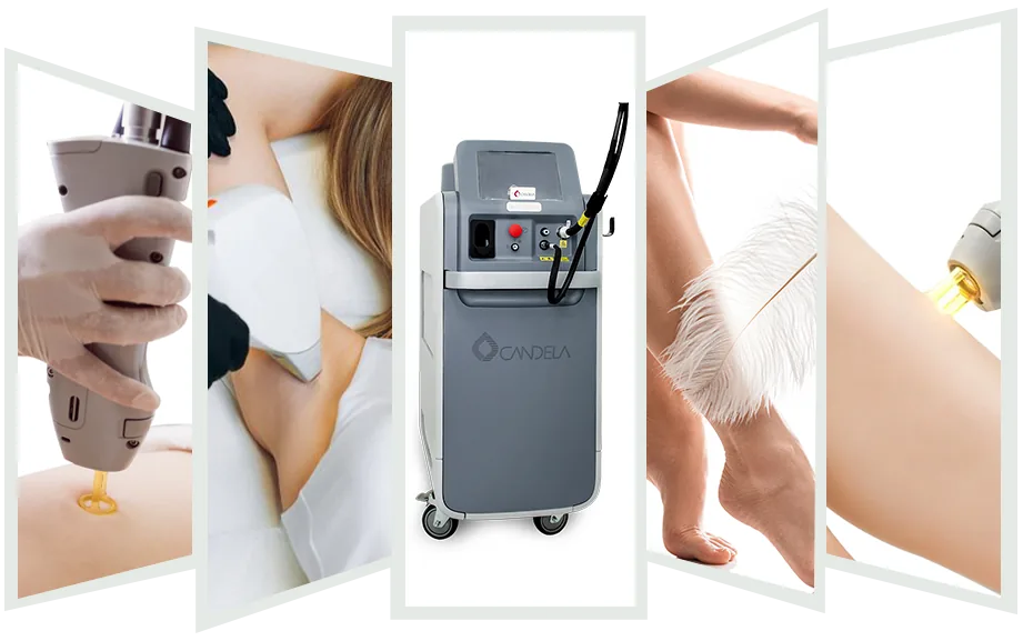 Candela laser hair removal device
